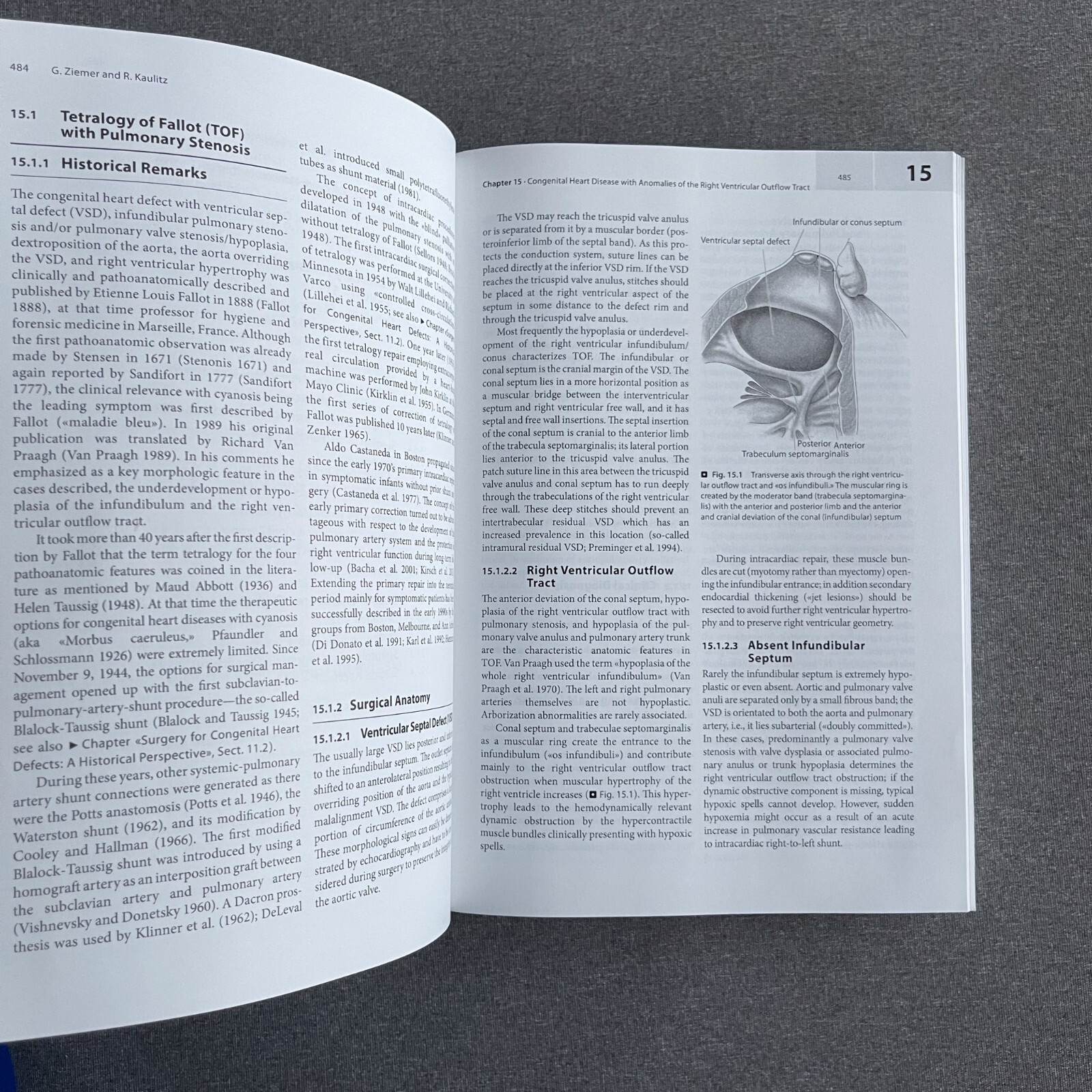 Cardiac Surgery: Operations on the Heart and Great Vessels in Adults and Childre