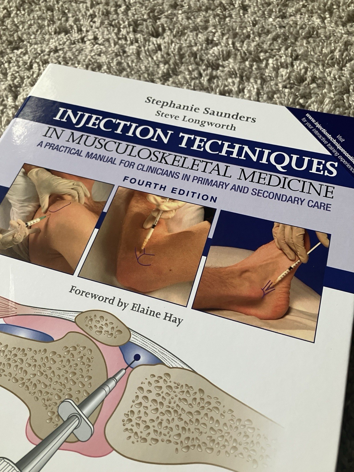 Injection Techniques in Musculoskeletal Medicine