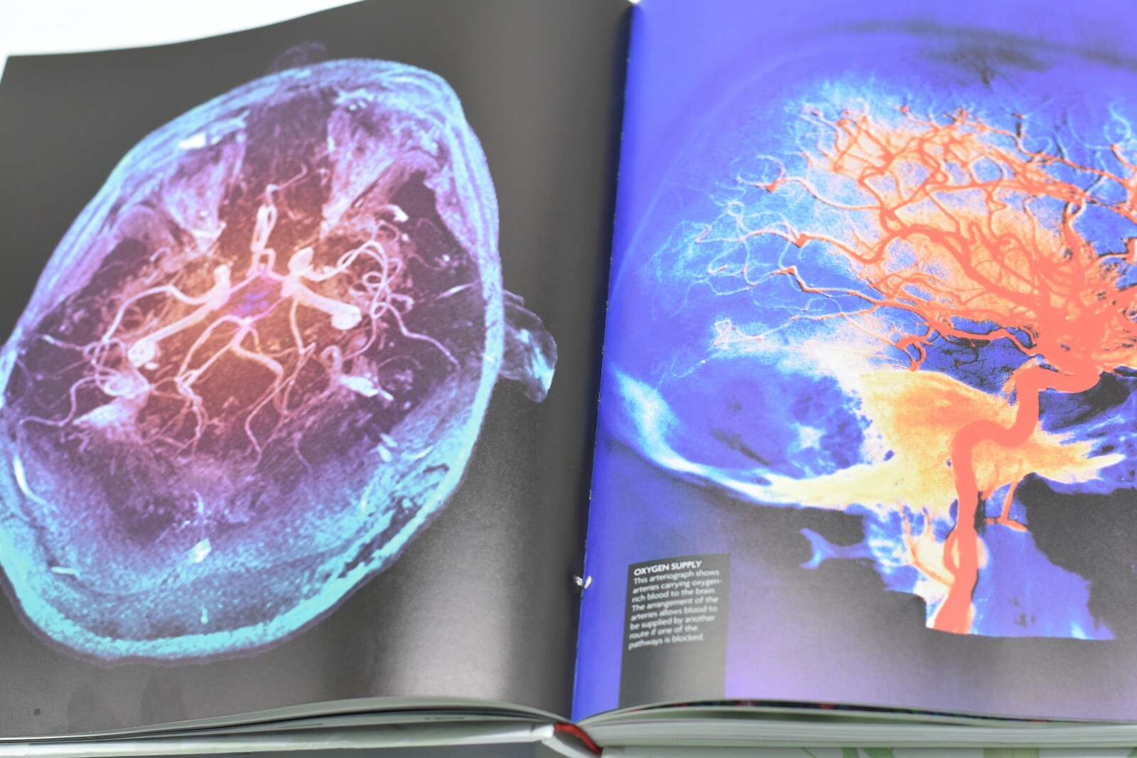 The Human Brain Book by Rita Carter. Hardcover book with SEALED DVD!!! FREE SHIP